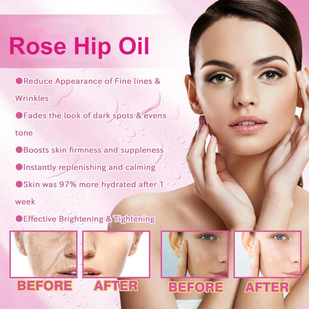 100ml Natural Organic Rose Hip Oil for Relaxing Massage and Hydration