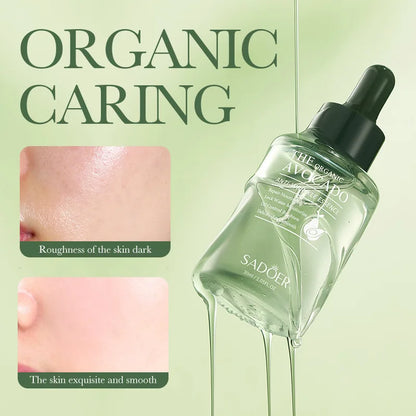 Avocado Oil Facial Serum: Organic Anti-Wrinkle & Acne Rejuvenation Essence