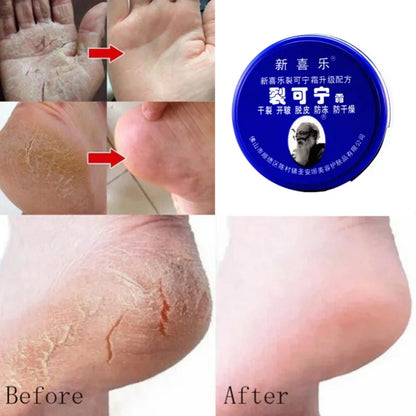 Cracked Skin Repair Cream